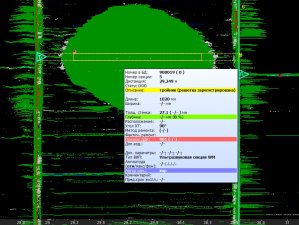 «Транснефть-Диаскан» введет в опытную эксплуатацию новую информационную систему